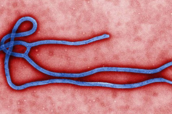 [Primeiro caso de ebola é confirmado na França]