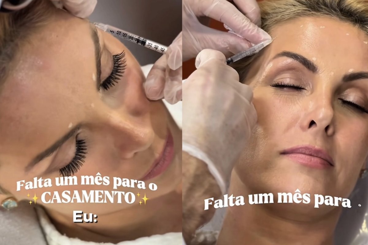 Ana Hickmann entra na reta final para o casamento e revela procedimentos estéticos!