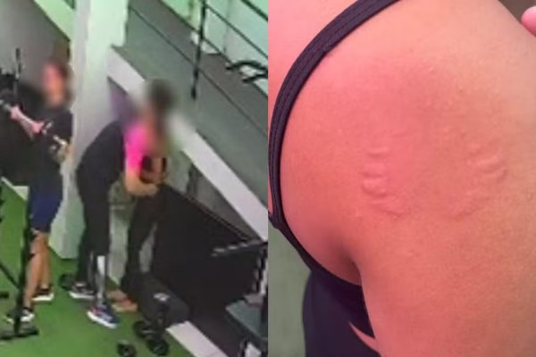 [Instrutor denunciado por morder aluna em academia afirma ter agido 