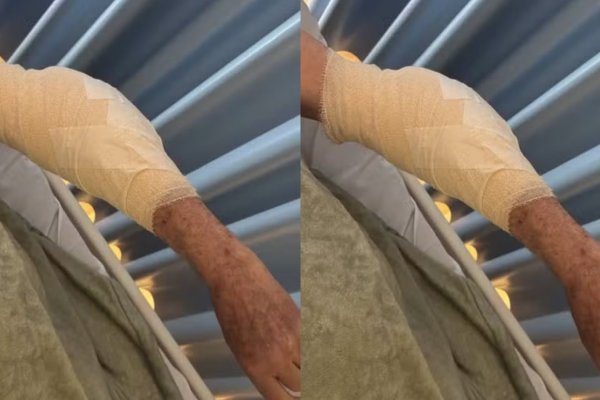 [Idoso leva mais de 20 pontos após ataque de pitbull em Salvador]