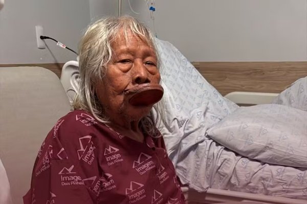 [Aos 94 anos, Cacique Raoni é diagnosticado com câncer no sistema digestório]
