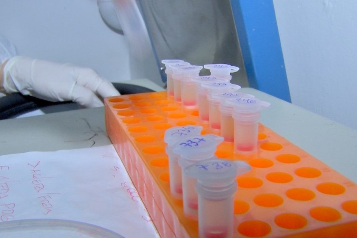 Número de casos de coronavírus da Bahia sobe para 49