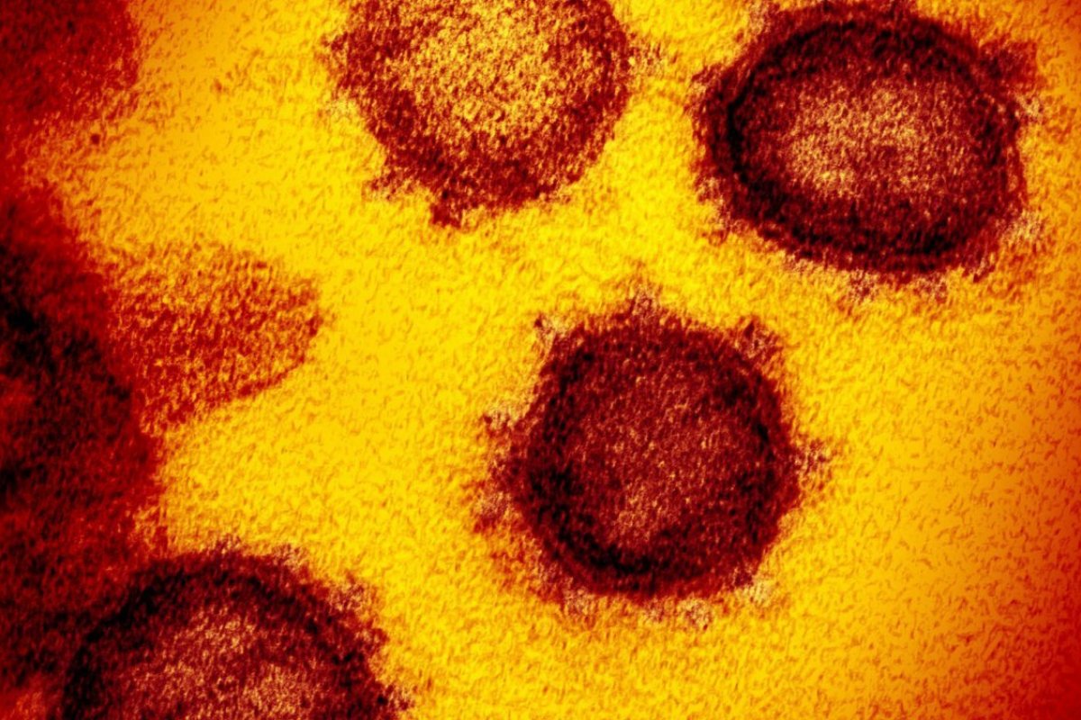 Covid-19: Mais da metade das infecções foram causadas por assintomáticos