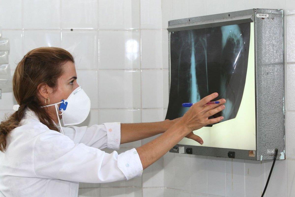 Tratamento da tuberculose não deve ser descuidado diz OMS