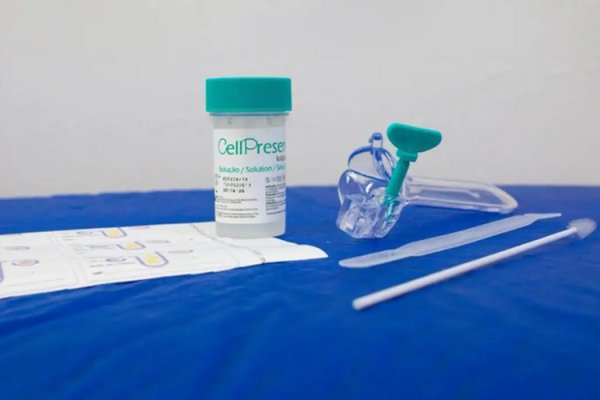 [SUS registra quase 10 mil exames positivos para HPV de alto risco ]