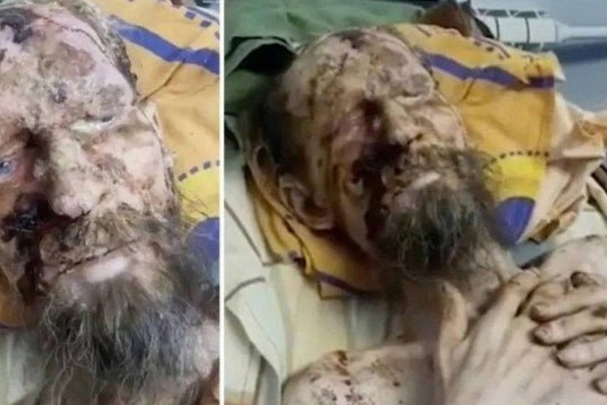 Homem 'múmia viva' é encontrado após um mês mantido 'refém' por urso