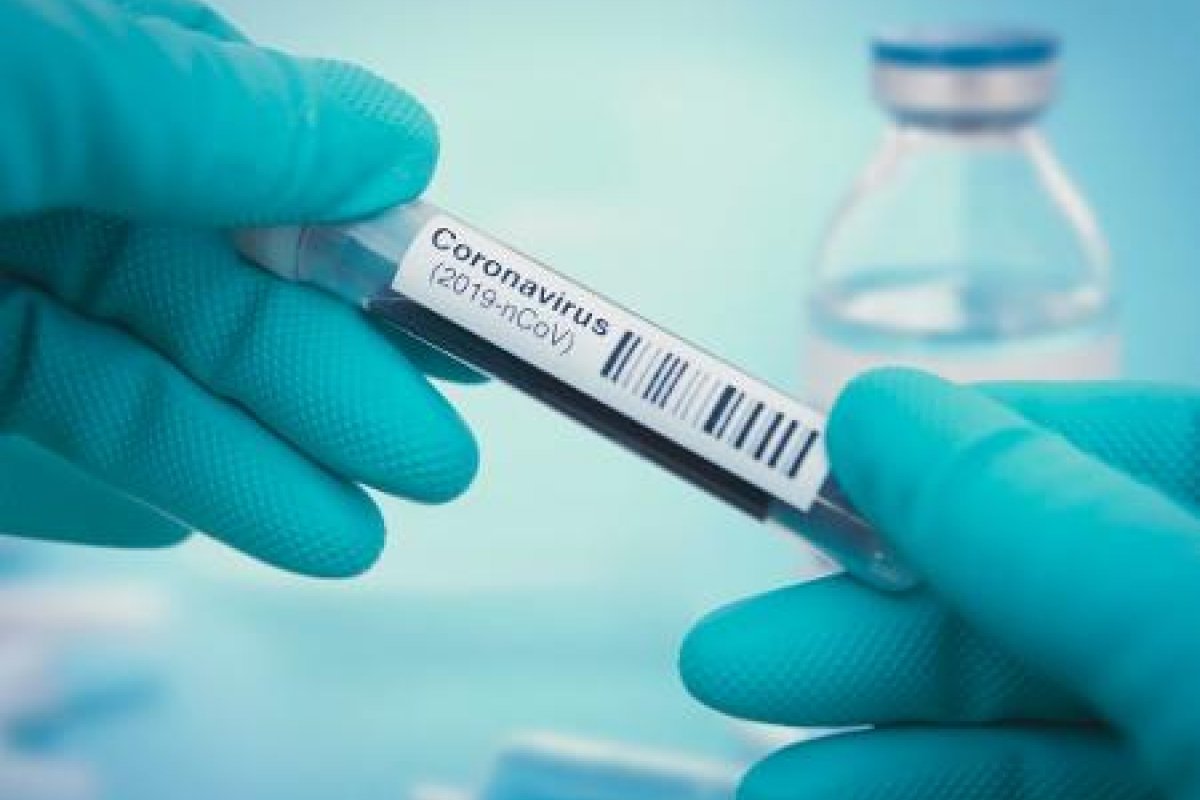 Espanha registra 864 mortes por coronavírus em 24 horas