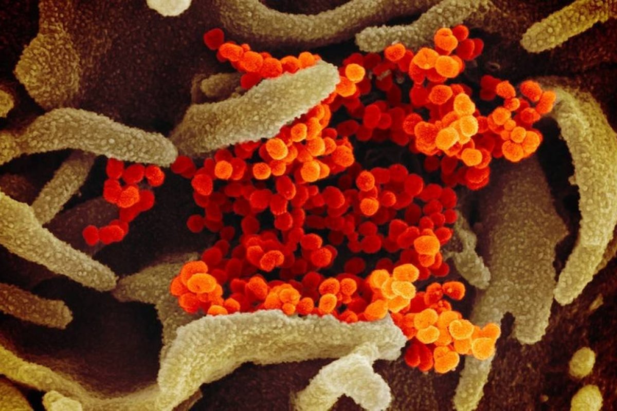 Pacientes com sintomas leves da Covid-19 liberam vírus em grande quantidade, aponta pesquisa