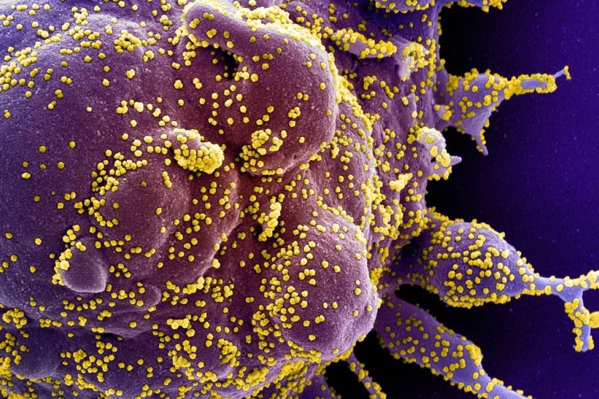 Coronavírus pode usar tática similar à da dengue para sabotar sistema imune