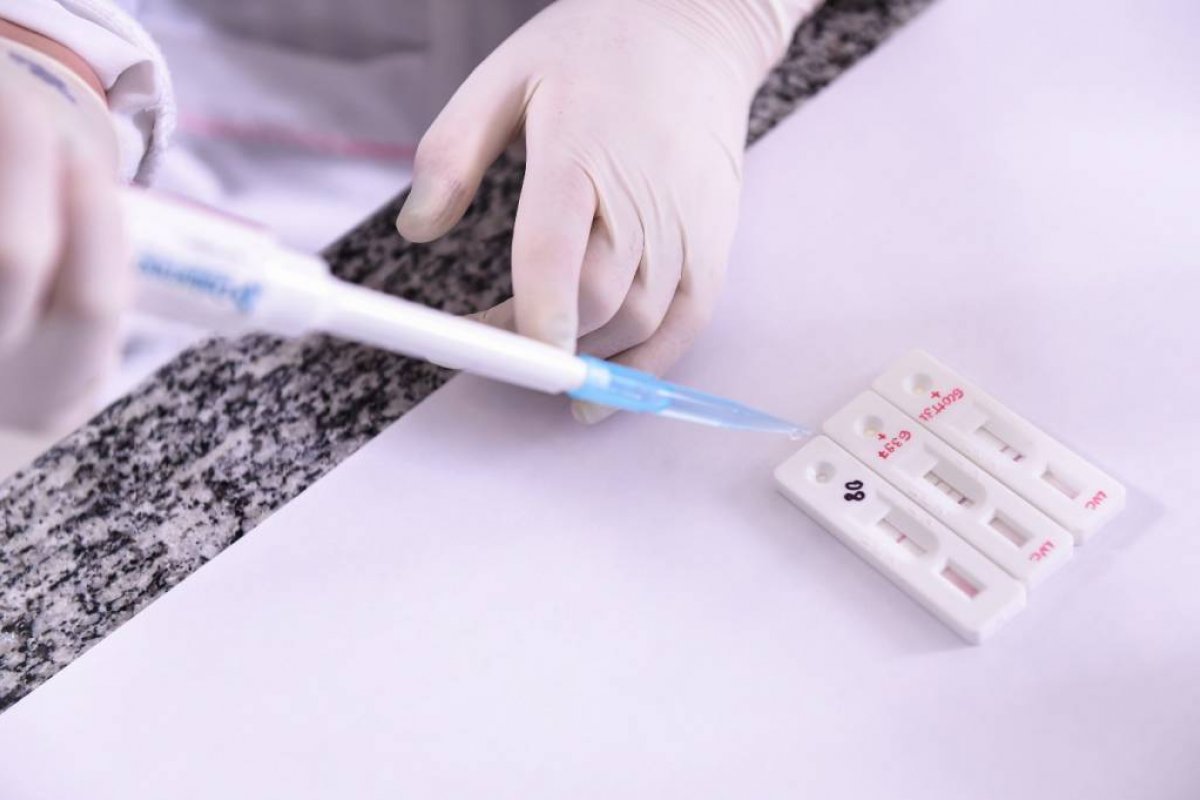 Governo fará 100 mil testes rápidos para mapear coronavírus no país