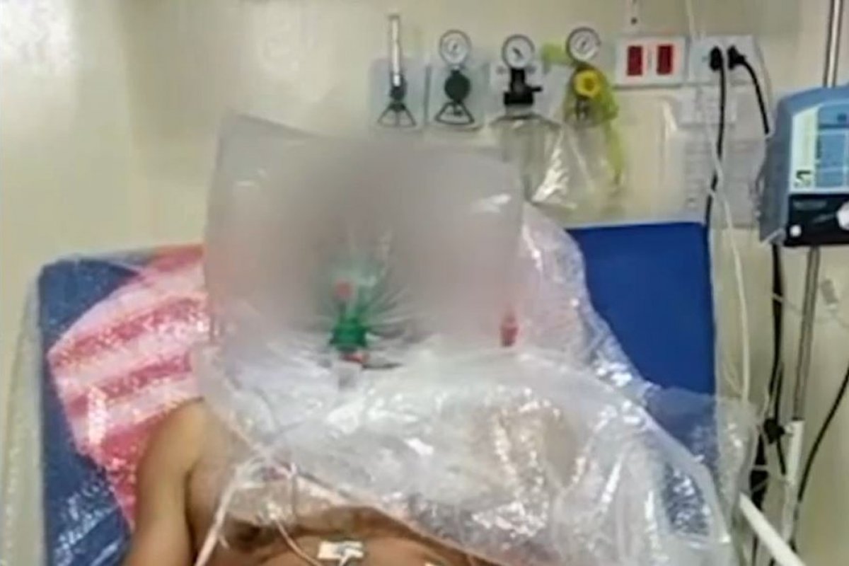 Paciente aguarda vaga em UTI de Amazonas respirando em saco plástico