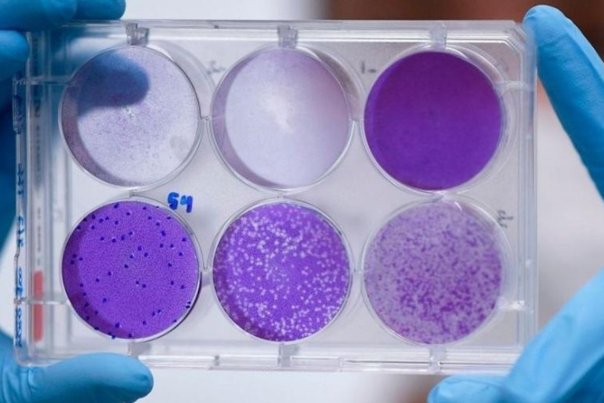 Coronavírus se transformou em 30 cepas distintas, revela estudo na China