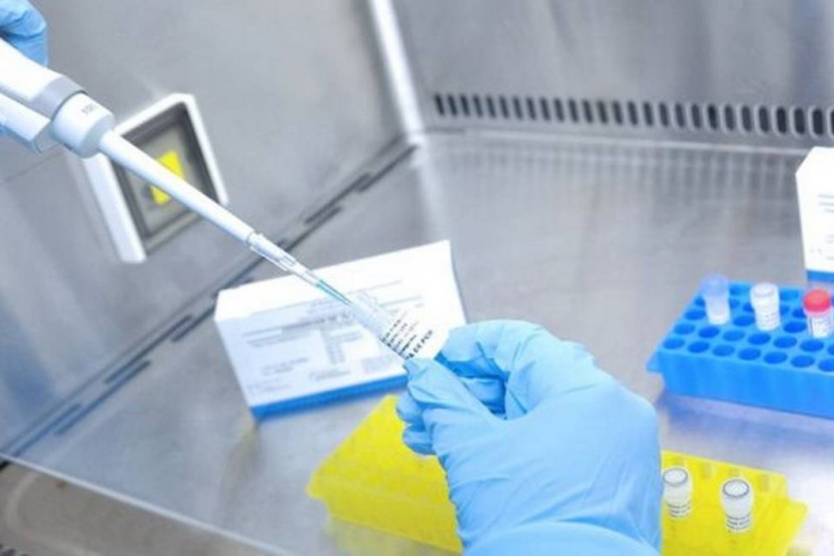 Brasil é um dos países que menos realiza testes para o coronavírus