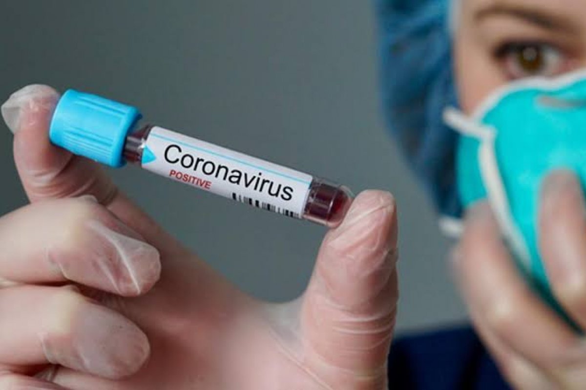 Brasil tem quase 200 brasileiros dispostos a se infectar com a Covid-19 para realizar testes de vacina