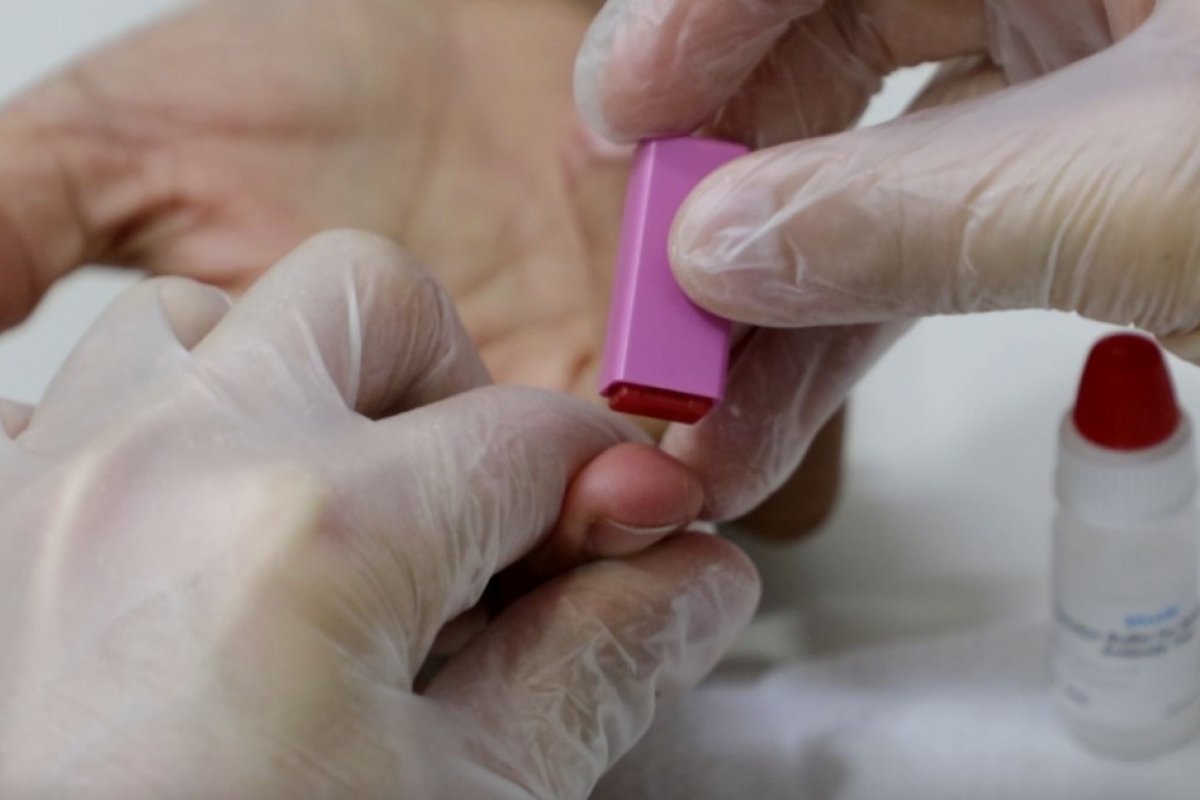 Anvisa libera realização de testes de Covid-19 em farmácias