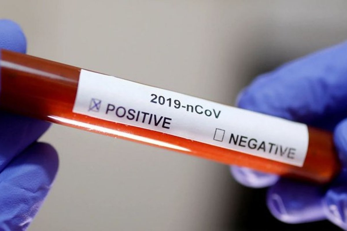 Sesab contabiliza mais 180 infectados pela covid-19 na Bahia