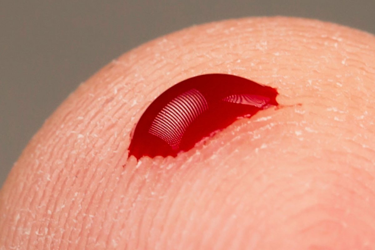 Nos EUA, empresas lucram com sangue de pacientes recuperados do coronavírus