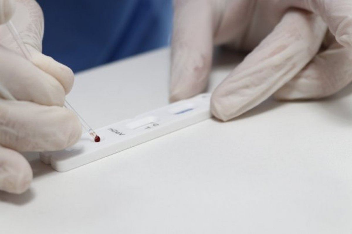 Conquista recebe mais de 5 mil testes rápidos para coronavírus