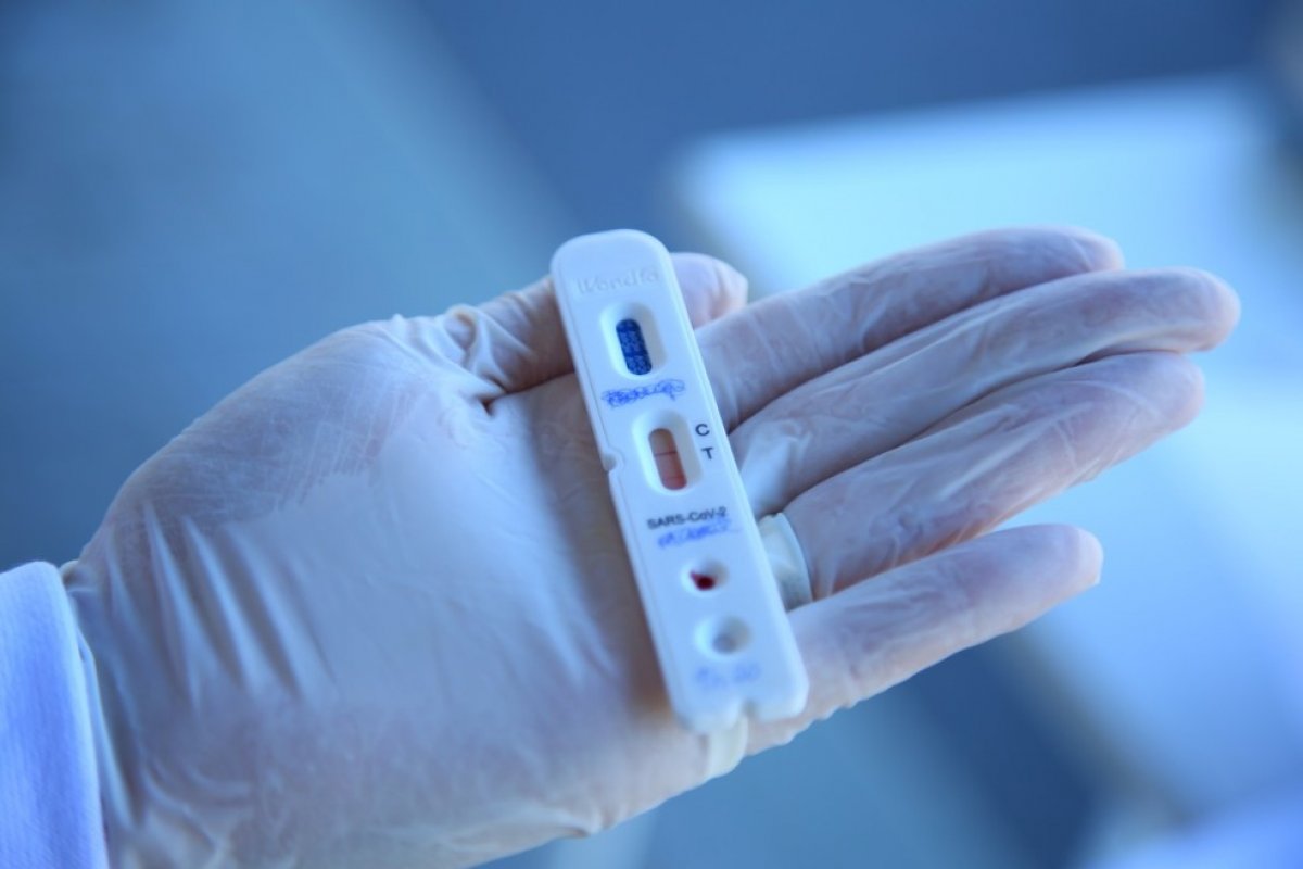 Golpistas vendem teste rápido para coronavírus que não é entregue