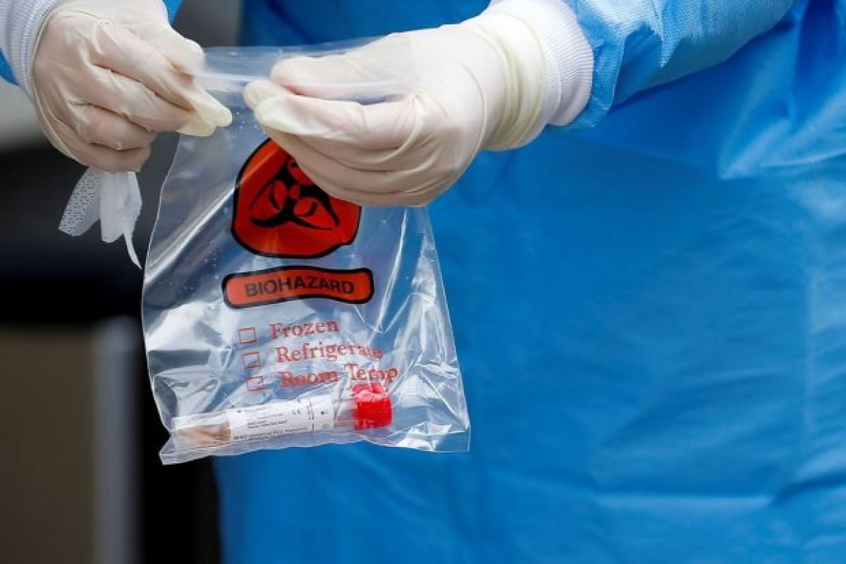 Cientes brasileiro inicia testes de terapia de anticorpos contra Covid-19 entre junho e setembro