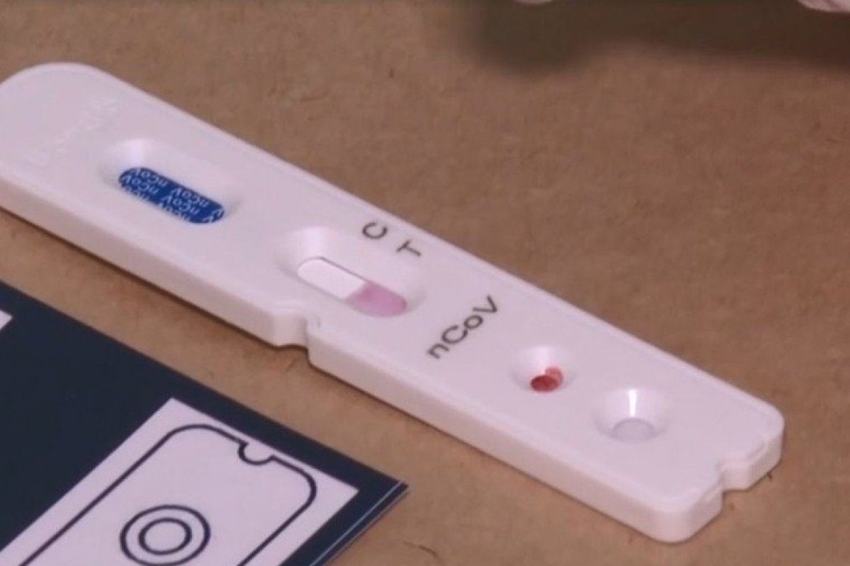 Testes para detecção da covid-19 usada pelo Ibope são furtados em SP