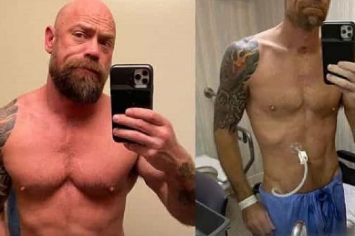 Americano mostra mudança no corpo após ser infectado pelo coronavírus