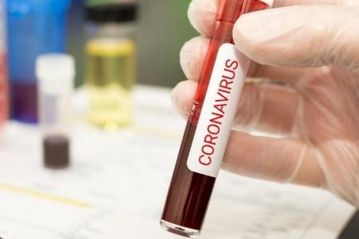 Covid19: locutor usa humor para alertar pessoas a permanecerem em casa durante pandemia
