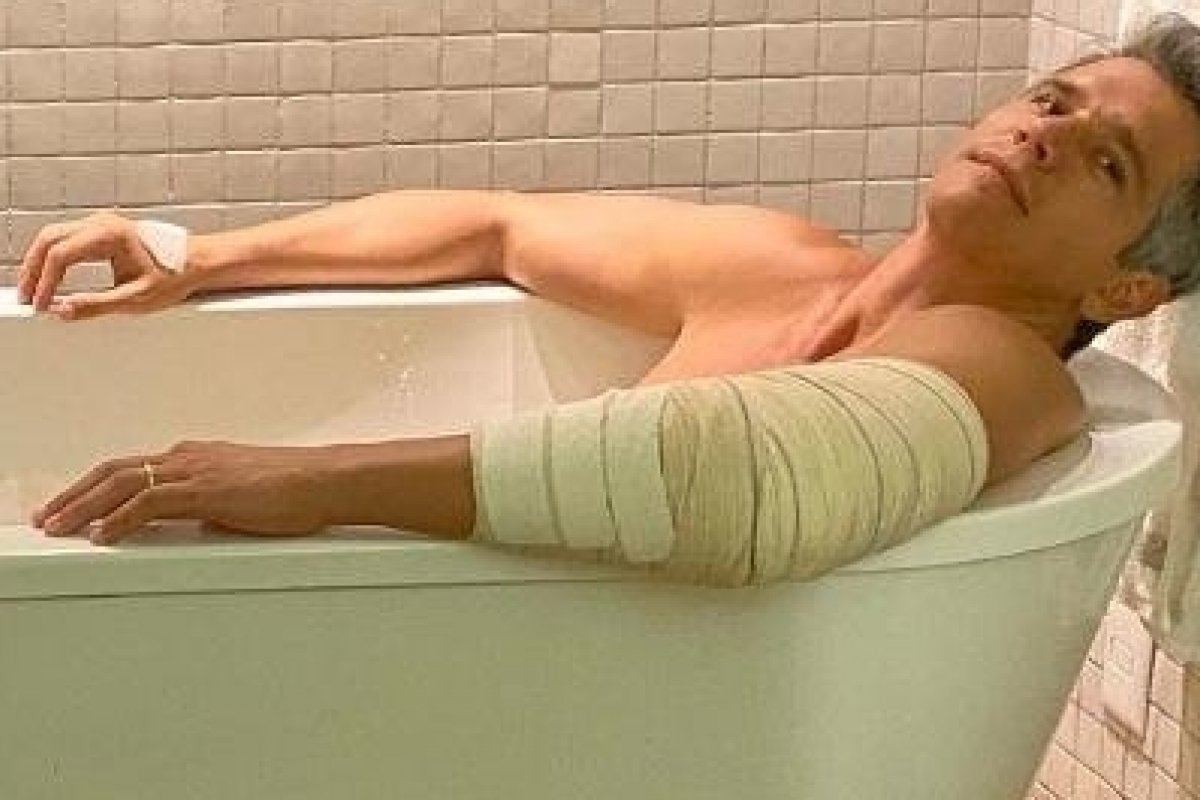 Com o braço imobilizado, Márcio Garcia faz reflexão na banheira
