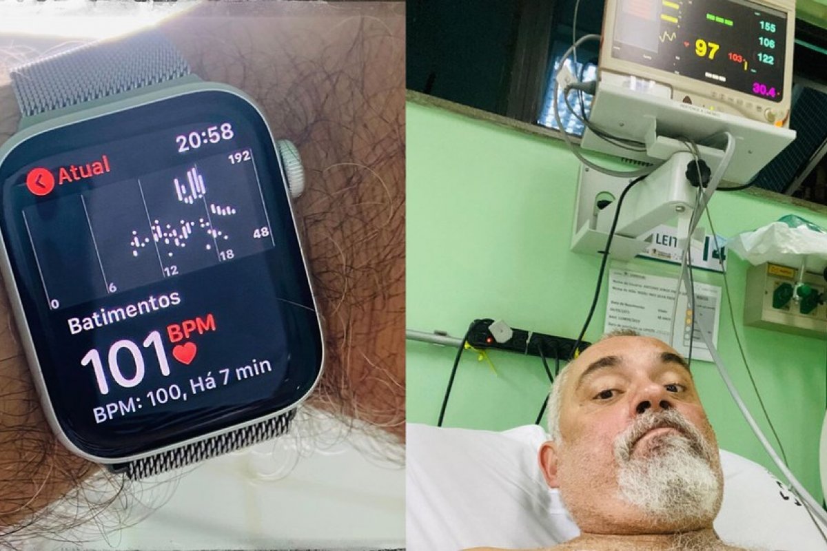 Anvisa libera função eletrocardiograma do Apple Watch no Brasil