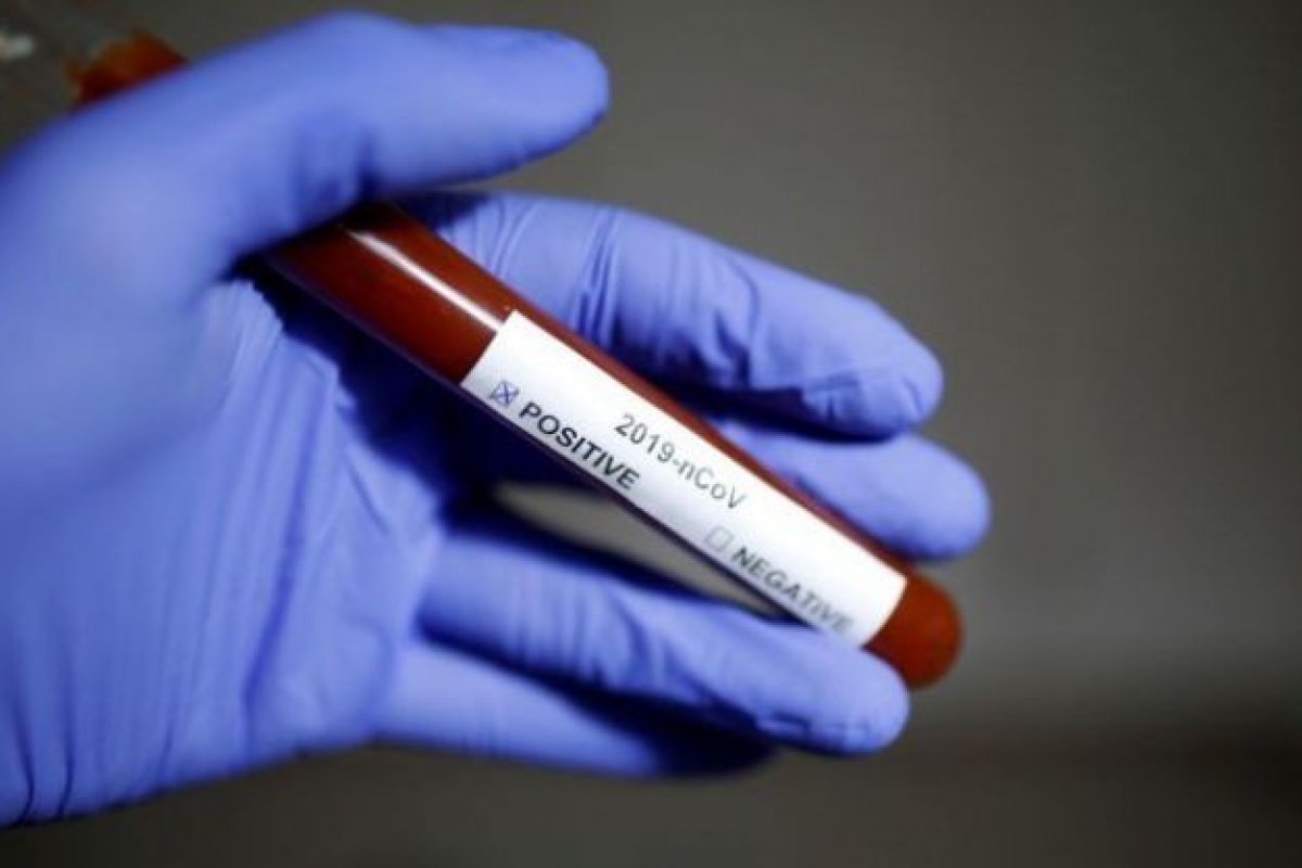 Brasil começa junho com mais de 510 mil casos de coronavírus confirmados