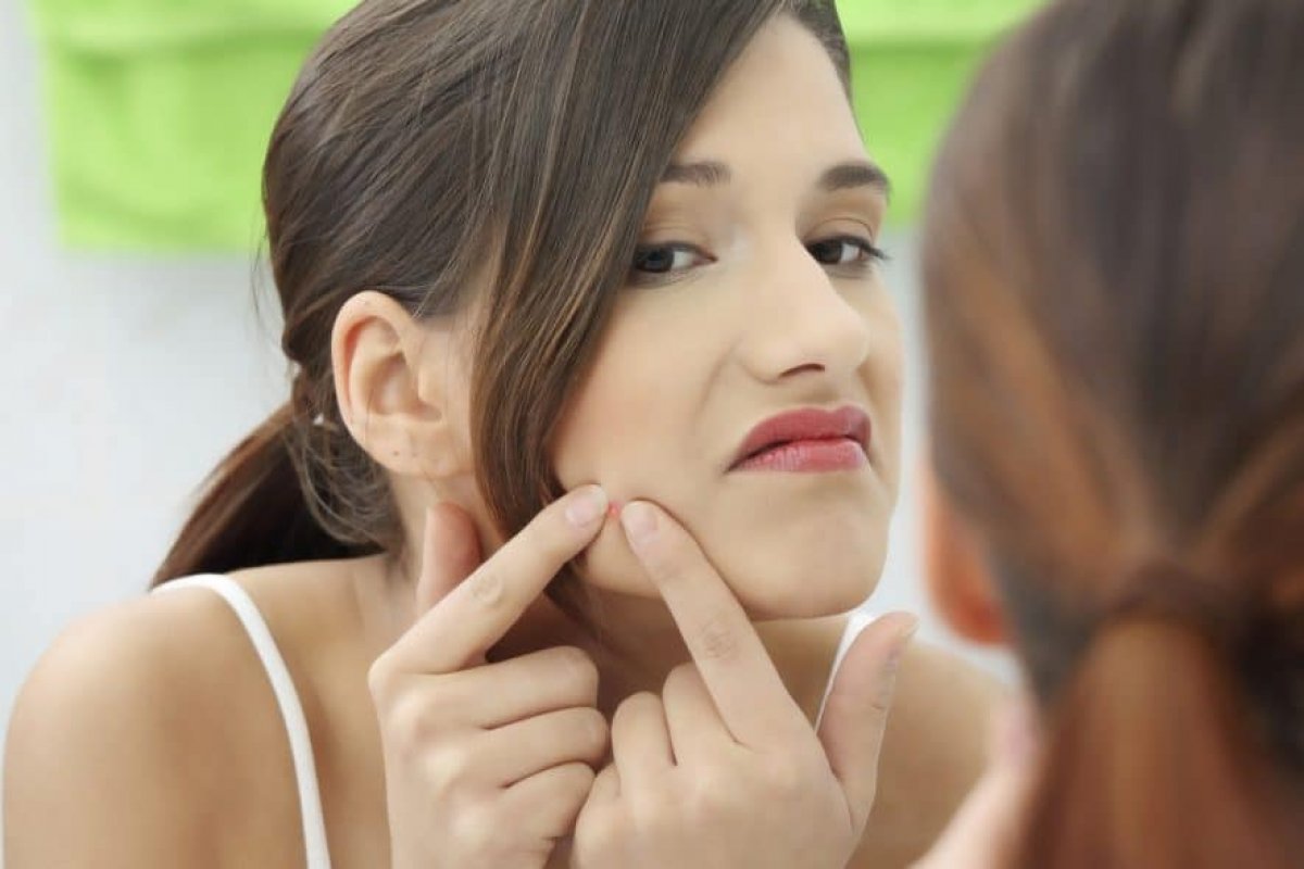 Não sofra com as cicatrizes causadas pelas acnes