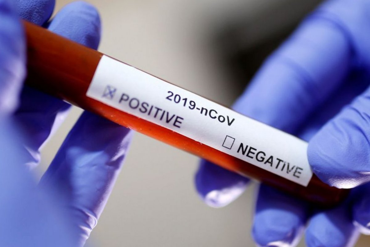 Testes rápidos detectaram 217 pessoas com Covid-19 em Salvador