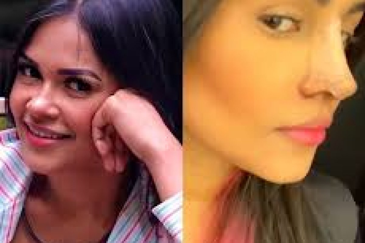 Após cirurgia plástica, ex BBB  é comparada a Michael Jackson e Bolsonaro