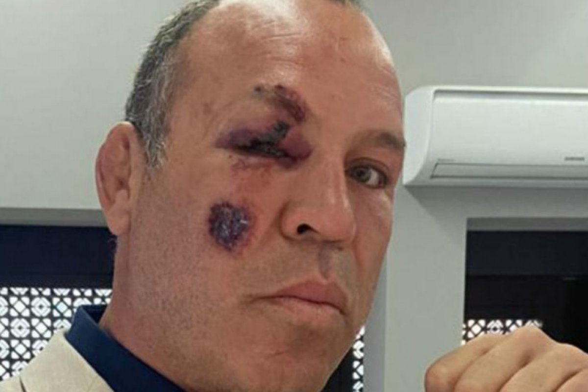 Wanderlei Silva é atropelado em Curitiba