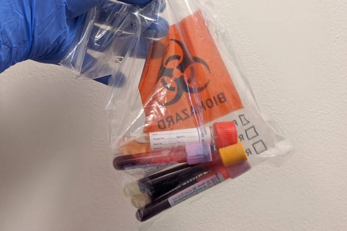 Pacientes com sangue ‘tipo A’ podem ter maior risco de complicação por Covid-19