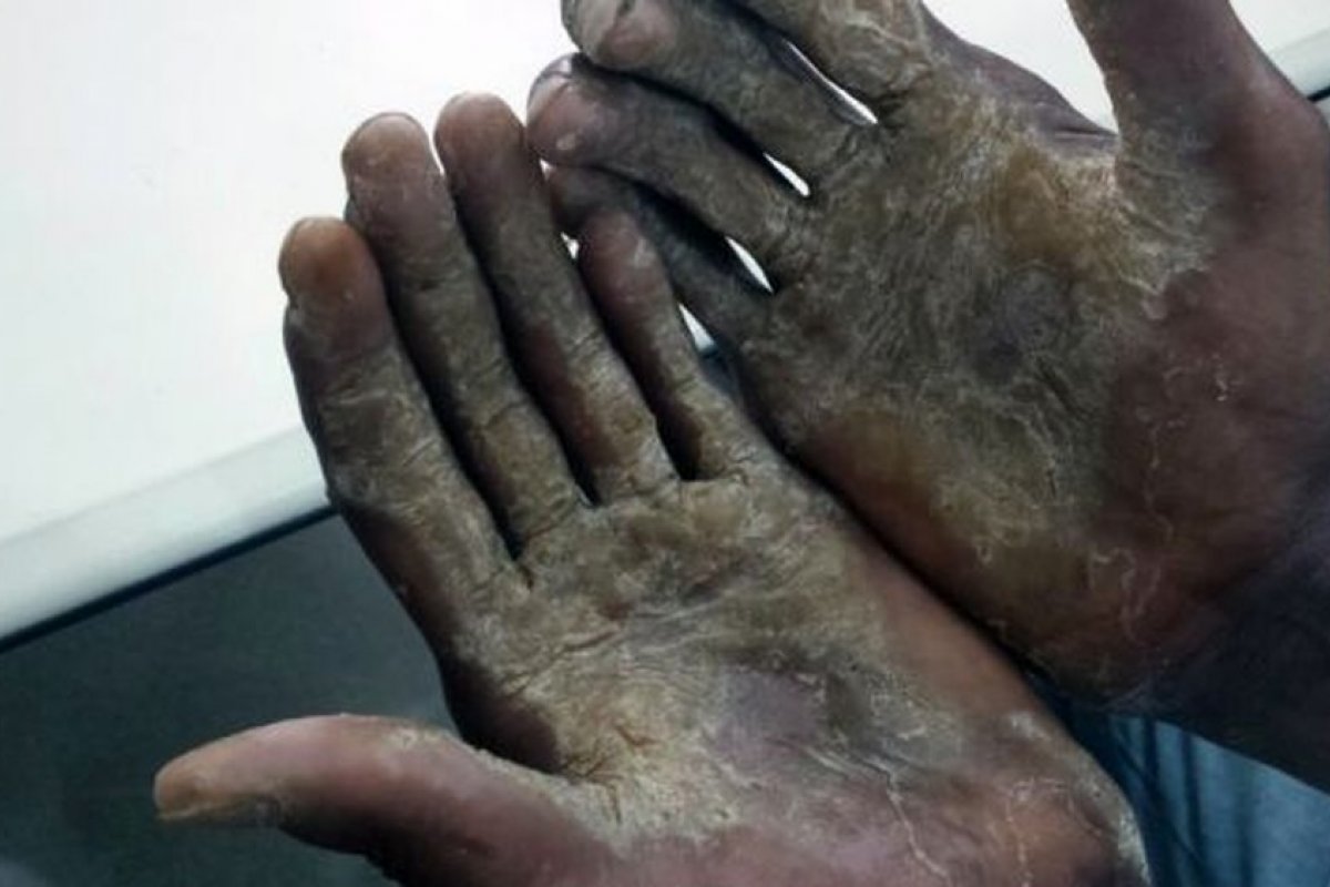 Empregada doméstica é mantida em situação semelhante à escravidão por 35 anos na Bahia