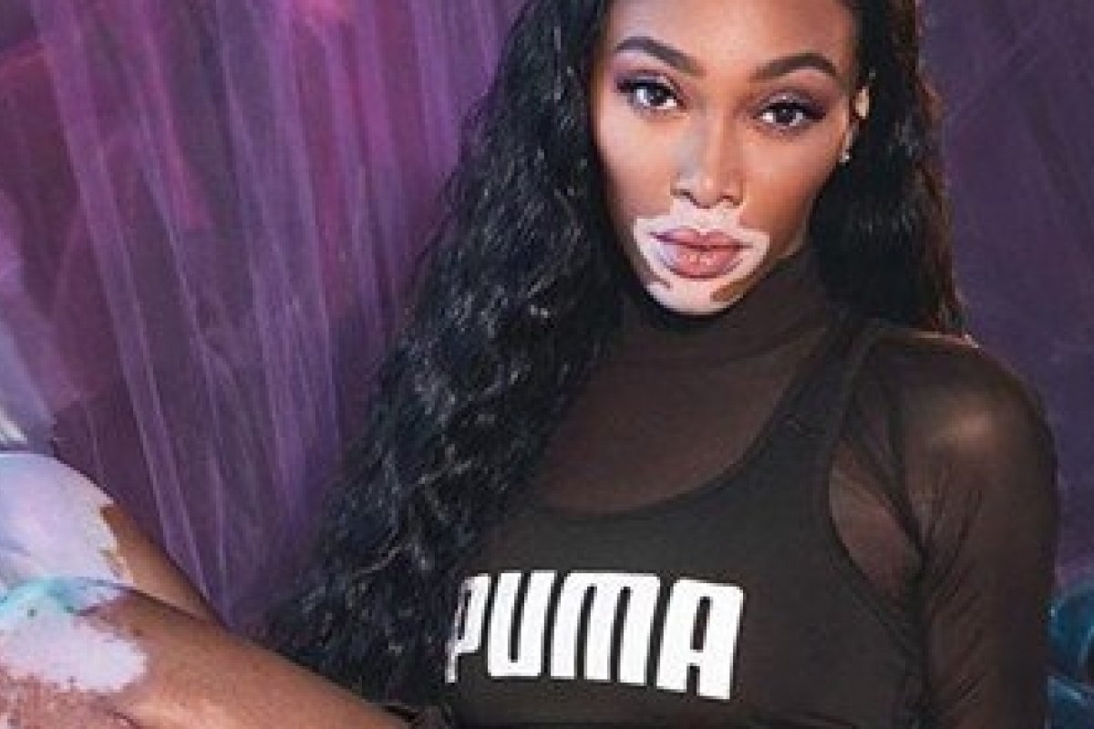 Winnie Harlow estrela campanha da Puma