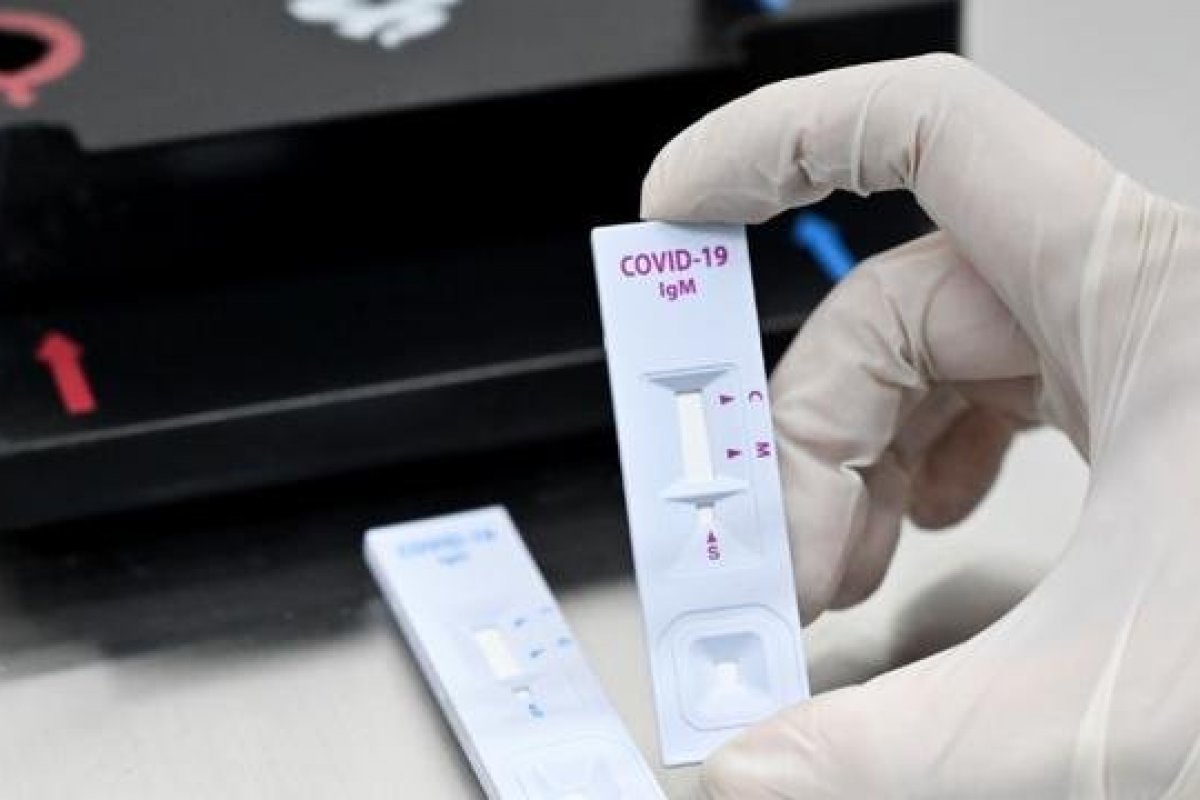 ANS obriga planos de saúde a incluir cobertura de teste de Covid-19