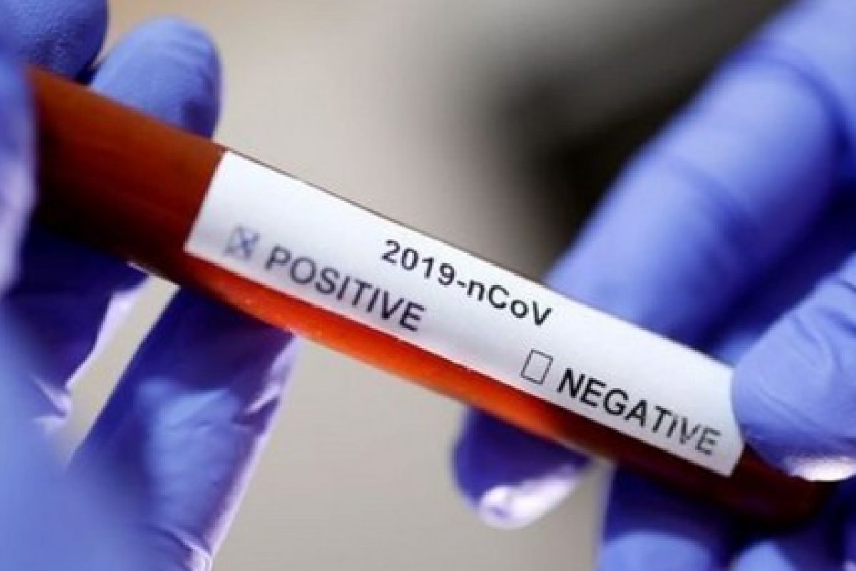 Atualização do número de casos e mortes por coronavírus no Brasil