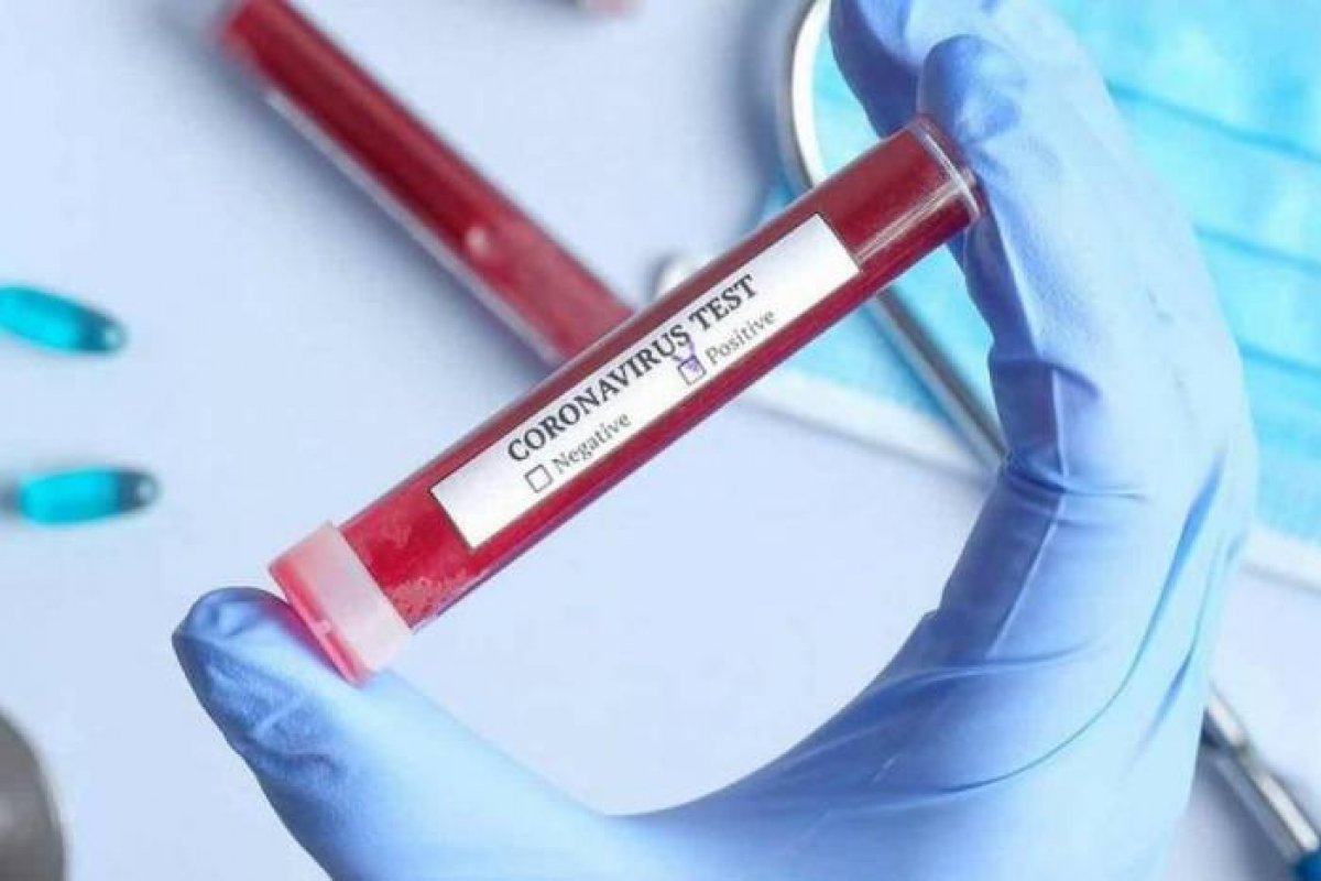 OMS avalia que pico de casos de coronavírus no Brasil deve ocorrer em agosto