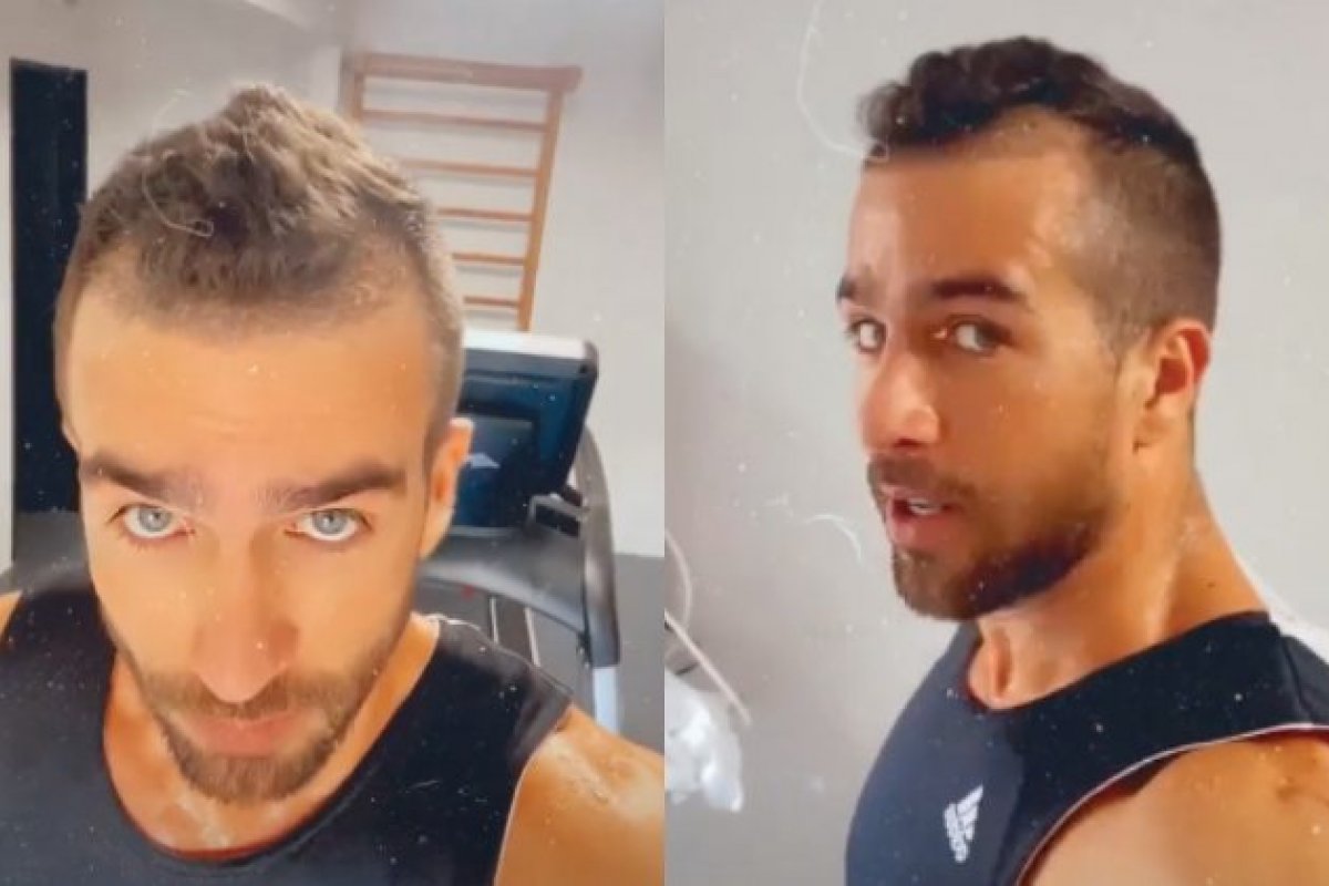 Erasmo Viana, marido de Gabriela Pugliesi, se rende ao transplante capilar