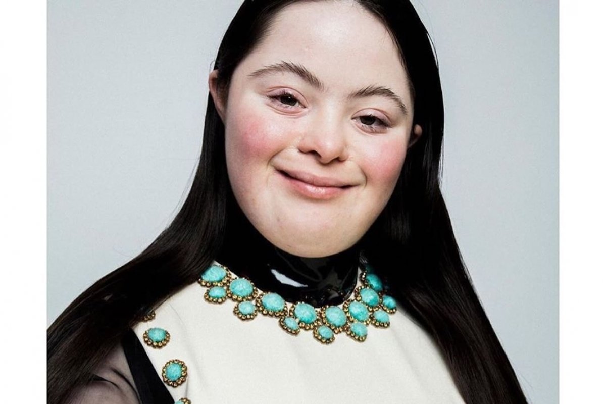 Modelo com síndrome de Down estrela campanha da Gucci