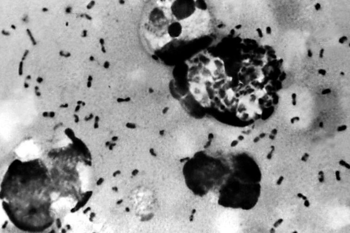 Cidade em região chinesa emite alerta sobre caso suspeito de peste bubônica