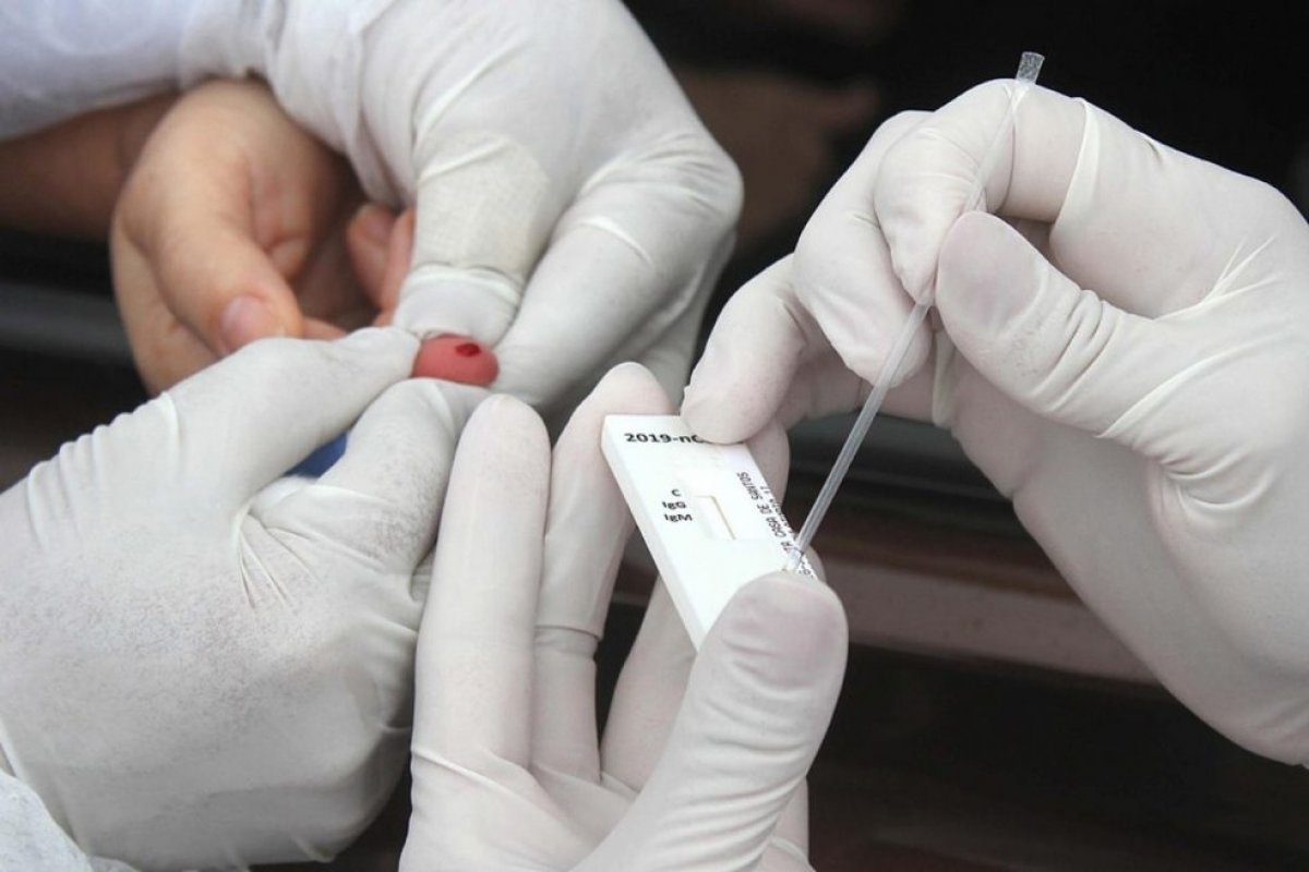 Brasil ultrapassa marca de 1 milhão de curados da Covid-19, afirma universidade