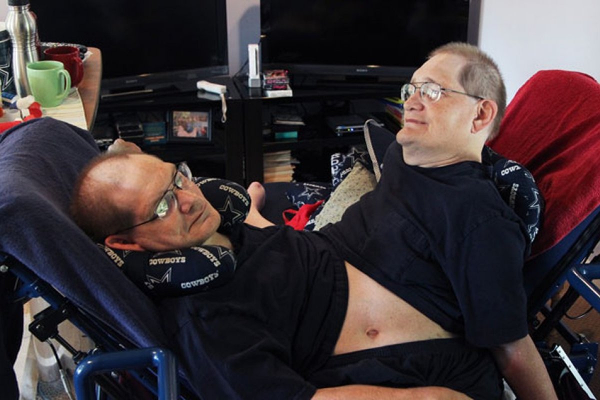 Morrem gêmeos siameses mais velhos do mundo