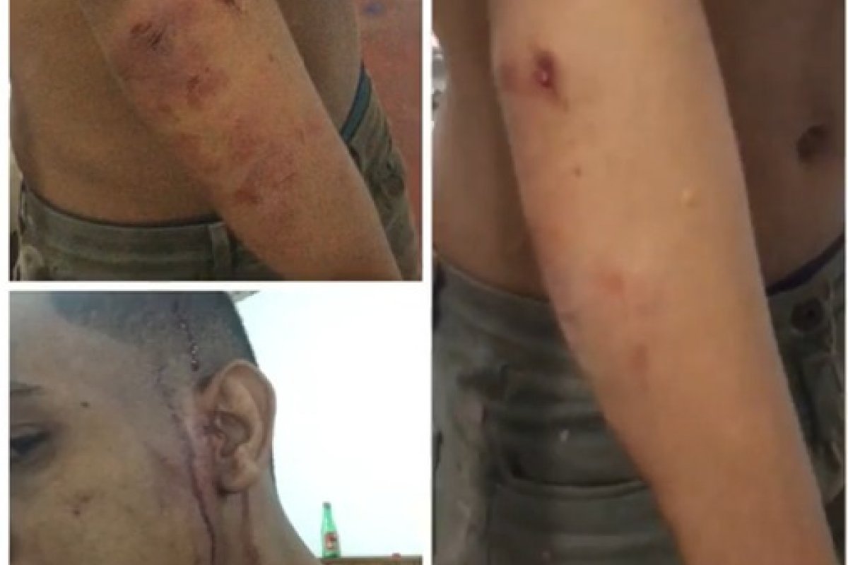 Homofobia: DJ de 21 anos é agredido em Salvador