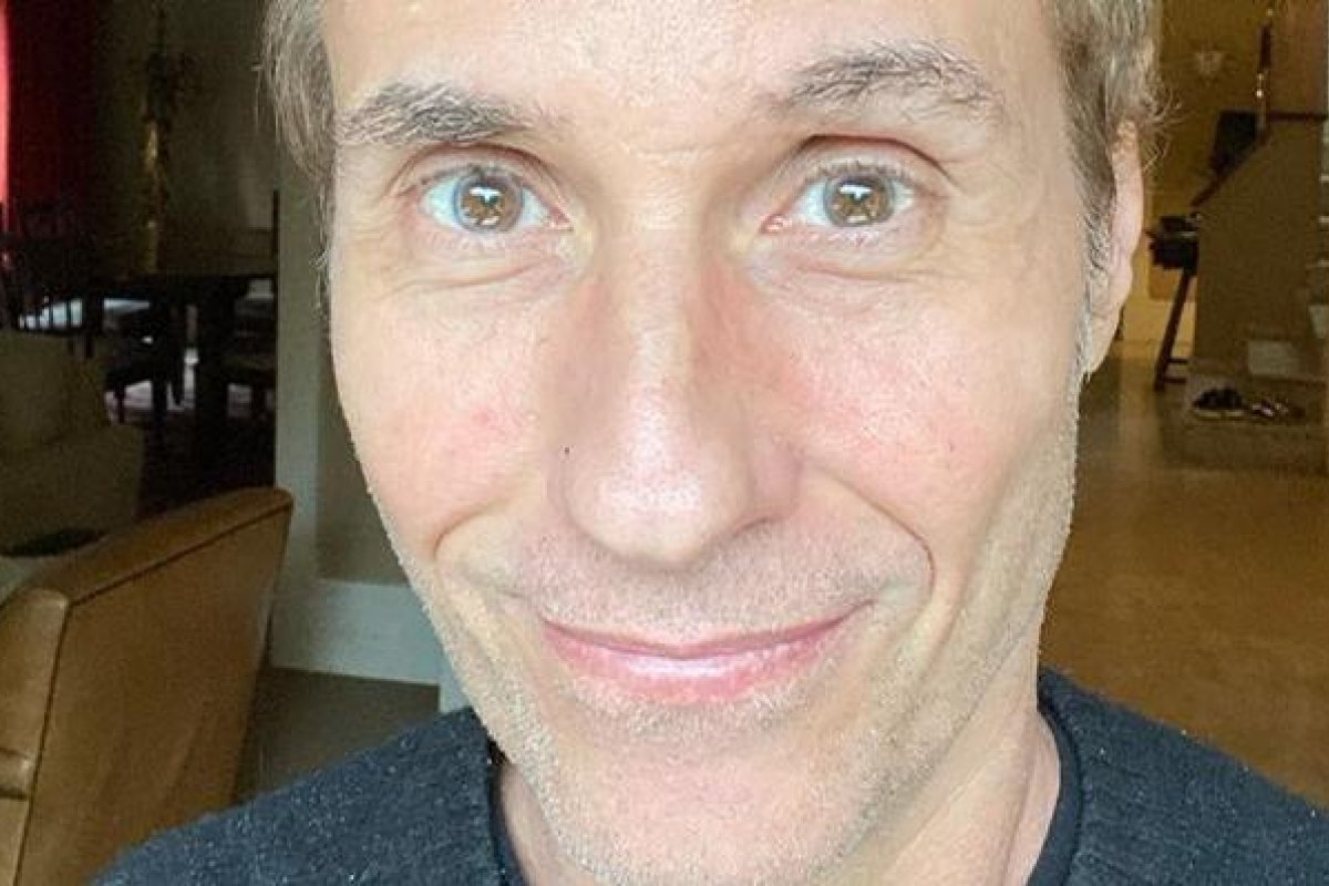 Curado do coronavírus, Dinho Ouro Preto revela sequelas da doença