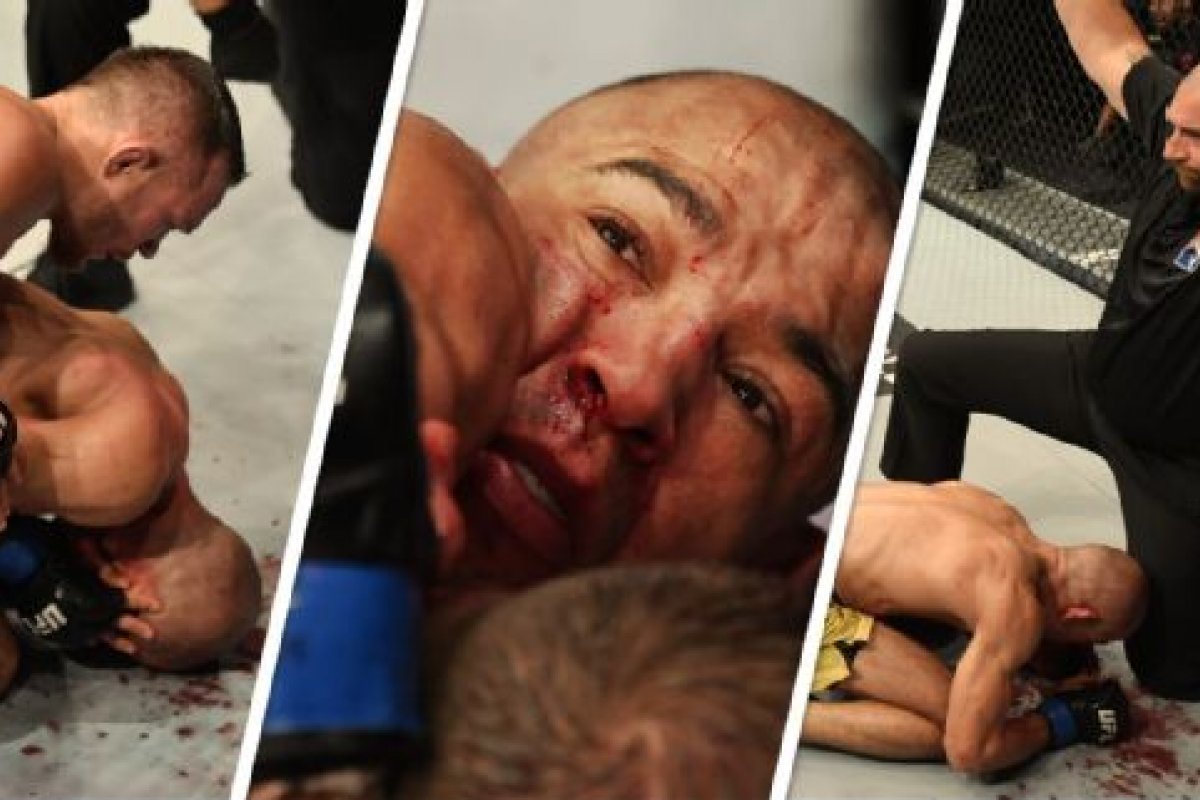 Em luta pelo UFC 251, Aldo leva 62 golpes no rosto em três minutos; postura do árbitro é criticada