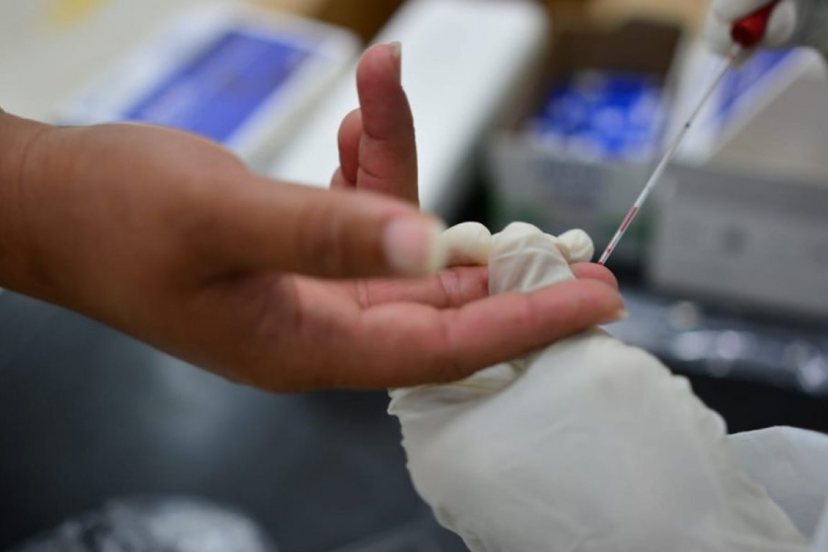 Brasil só atinge 20% da capacidade de testes de Covid-19