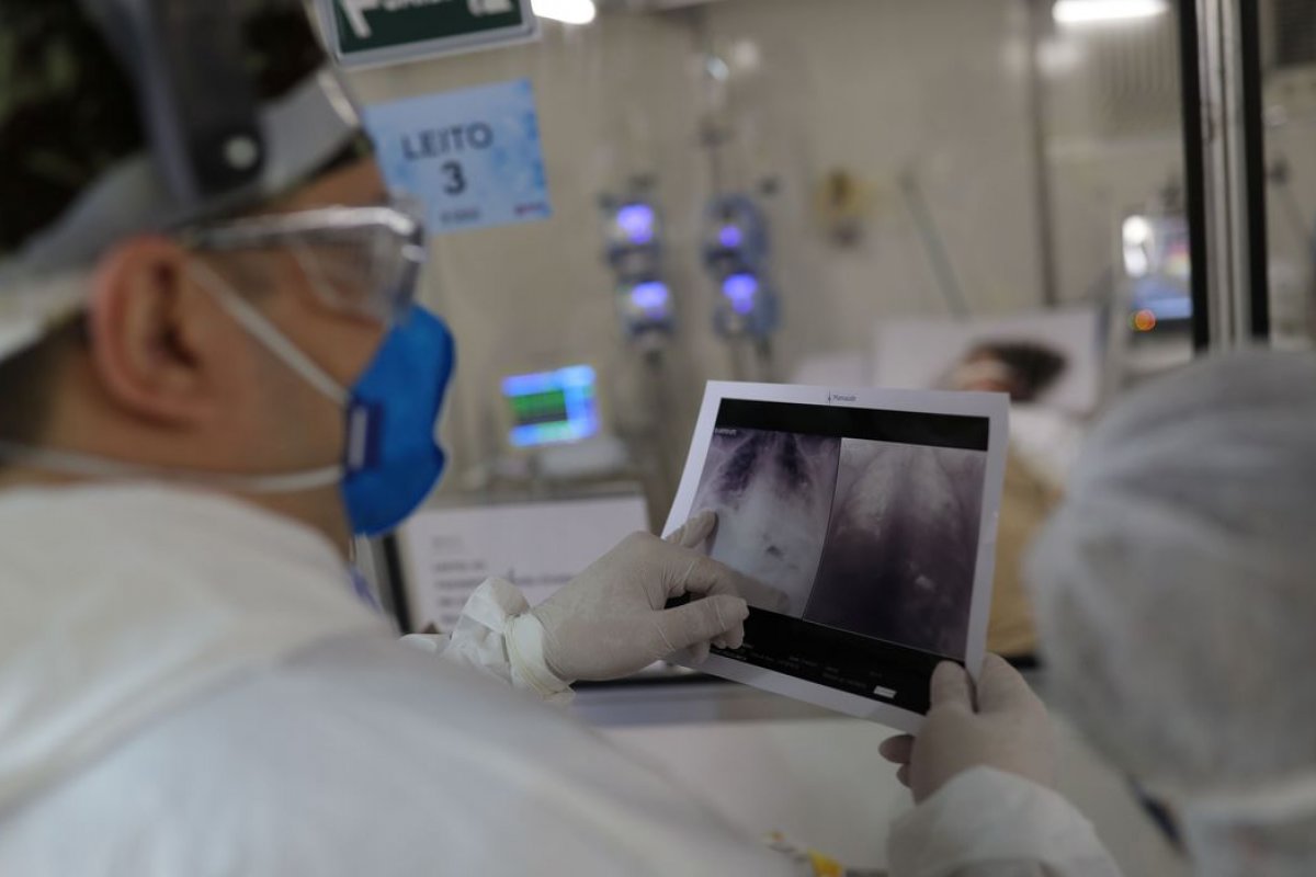 Estudo diz que uso de radiação nos pulmões de pacientes com Covid-19 pode acelerar recuperação